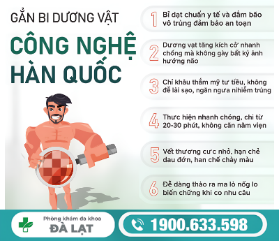 Hình ảnh minh họa